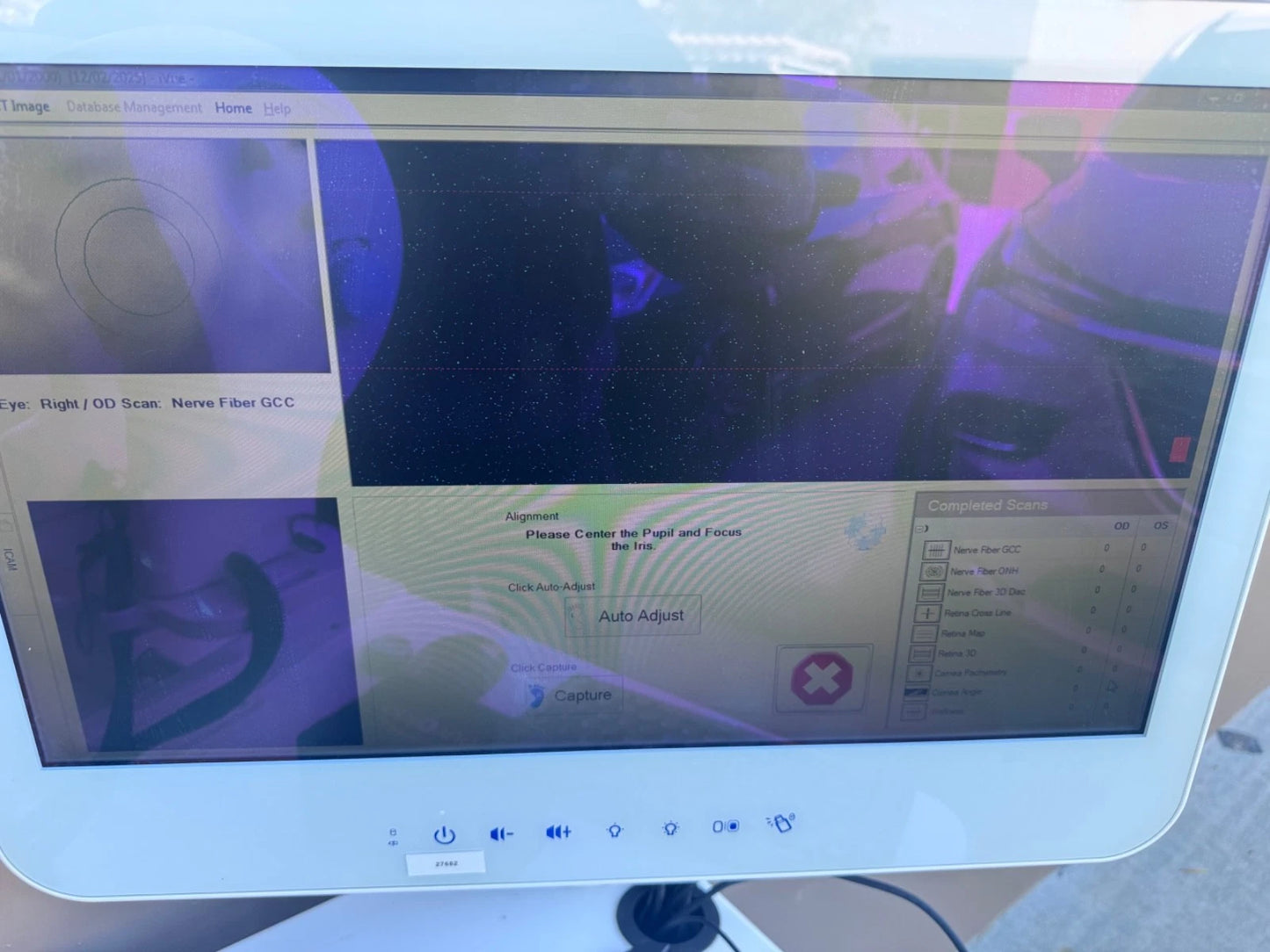 Optovue iFusion OCT and iCam