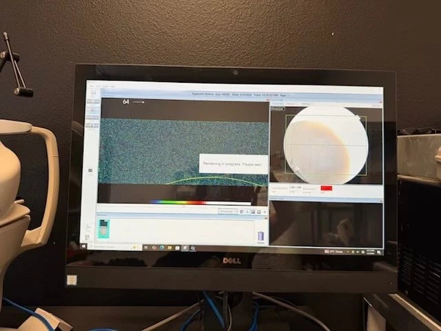 Topcon Maestro 3D OCT