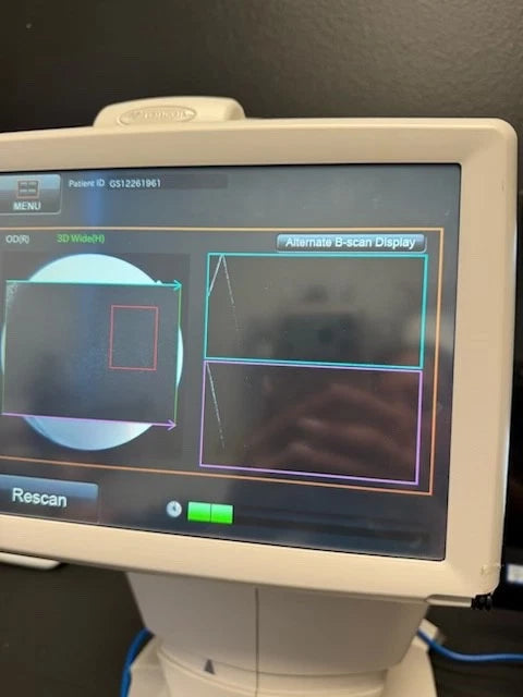 Topcon Maestro 3D OCT