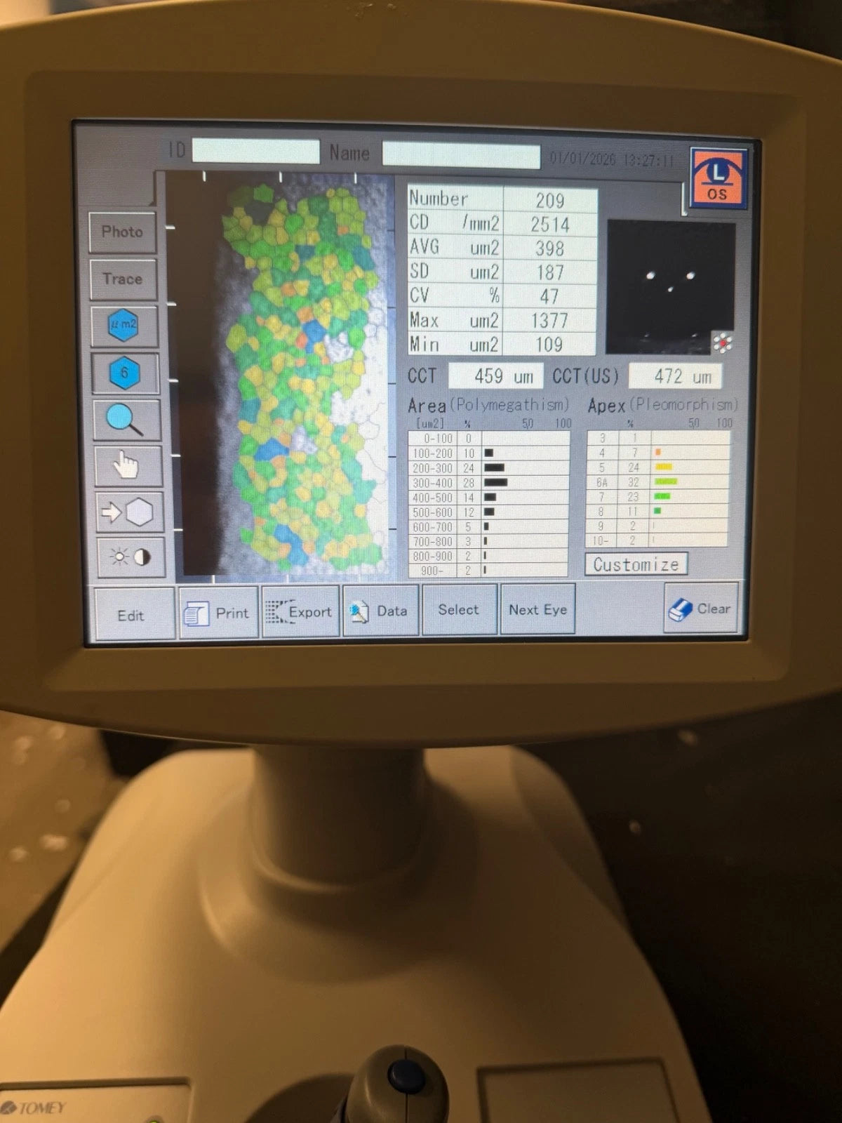 Tomey EM 3000 Specular Microscope