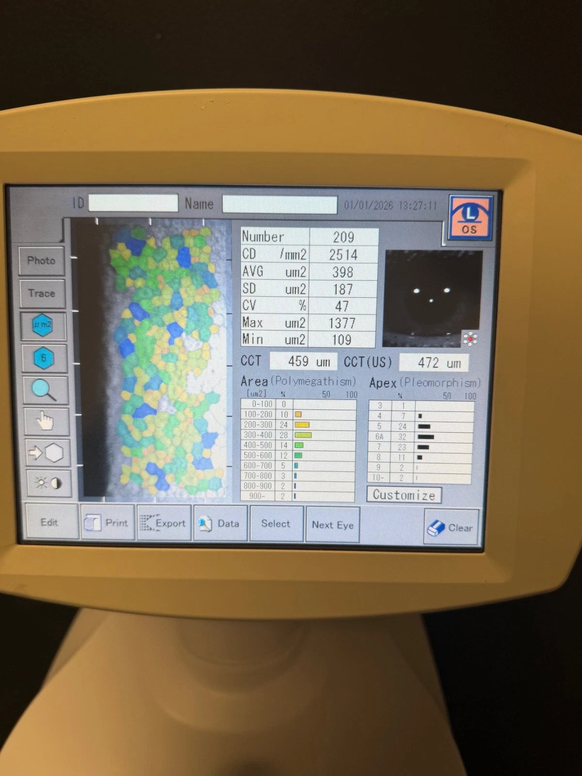 Tomey EM 3000 Specular Microscope