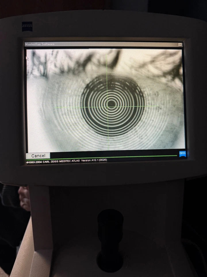 Zeiss Atlas 995 Corneal Topographer System