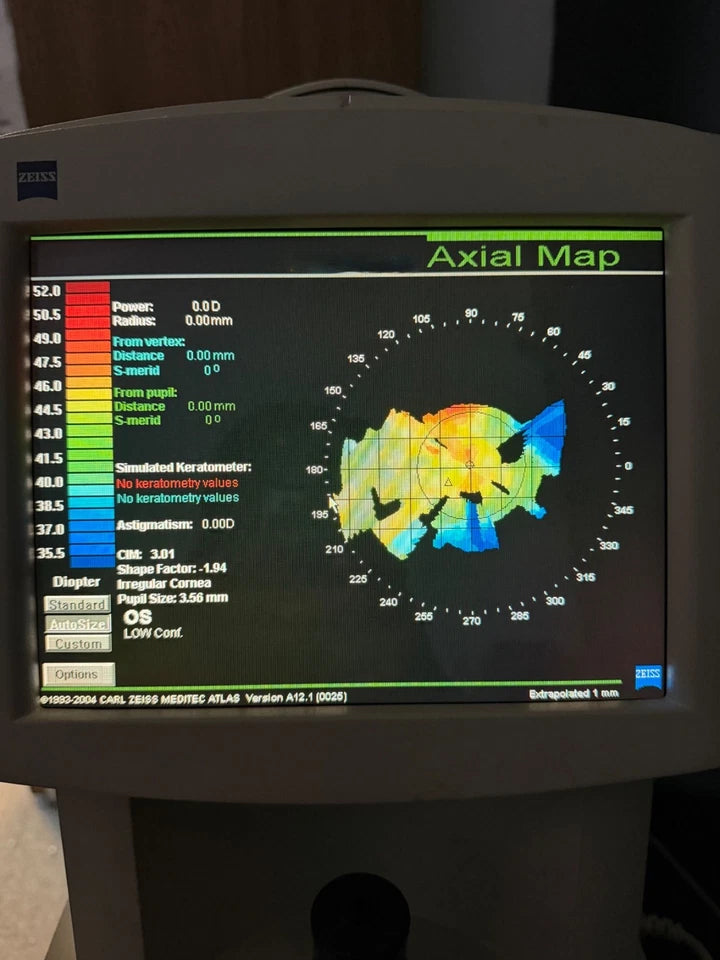 Zeiss Atlas 995 Corneal Topographer System